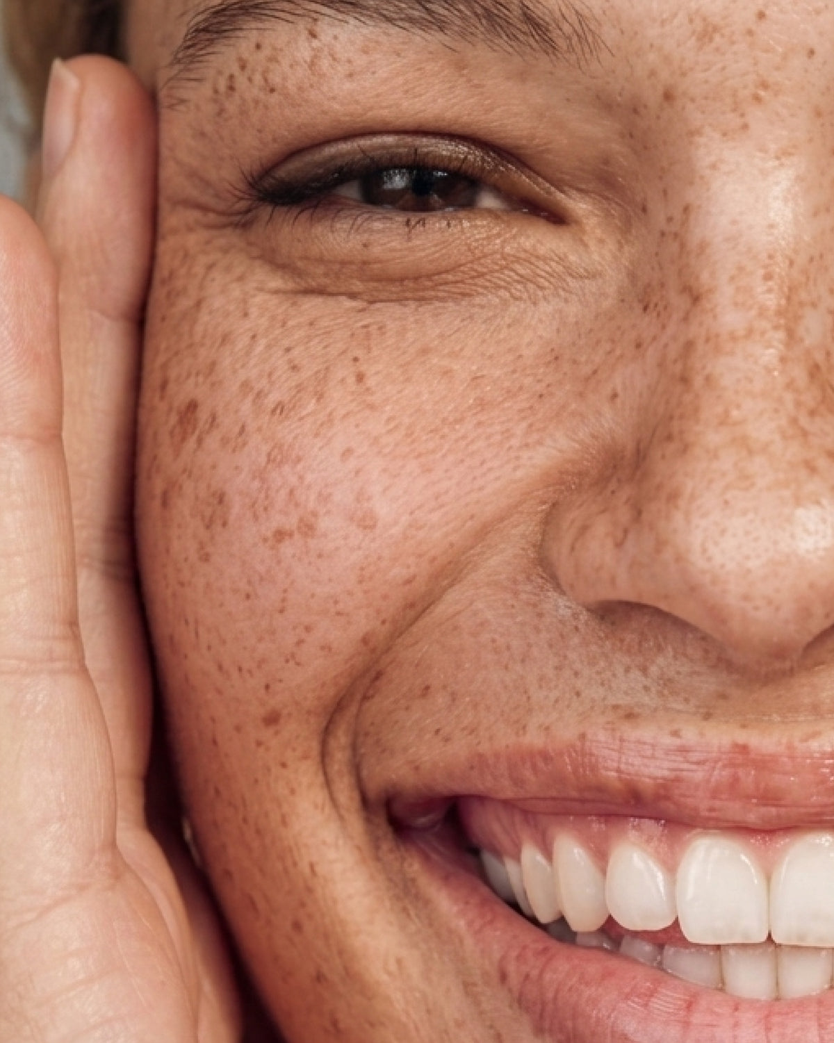 Close-up of a smiling freckled face with a hand against the cheek